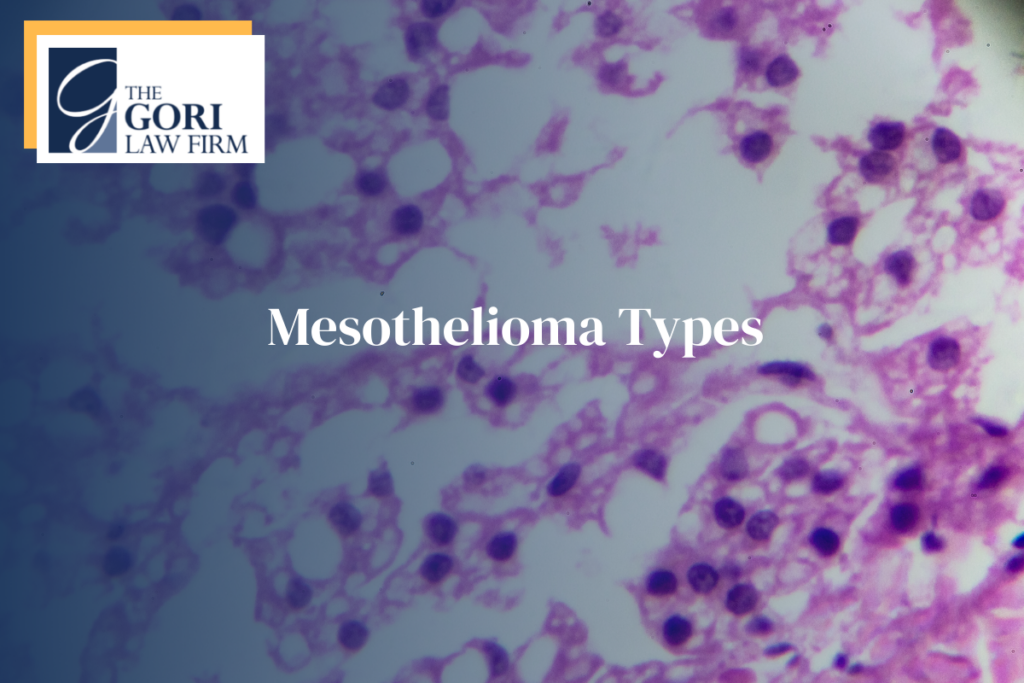 Types of Mesothelioma